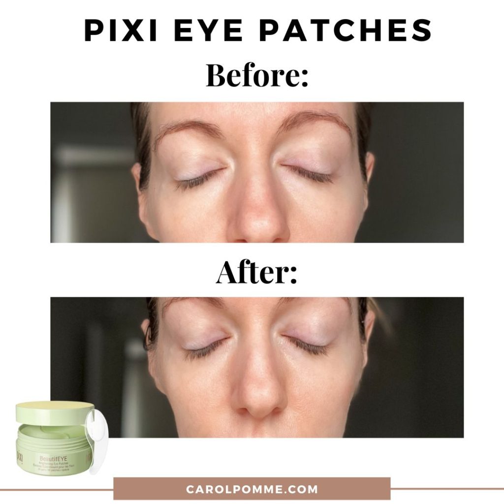 pixi eye patches before and after